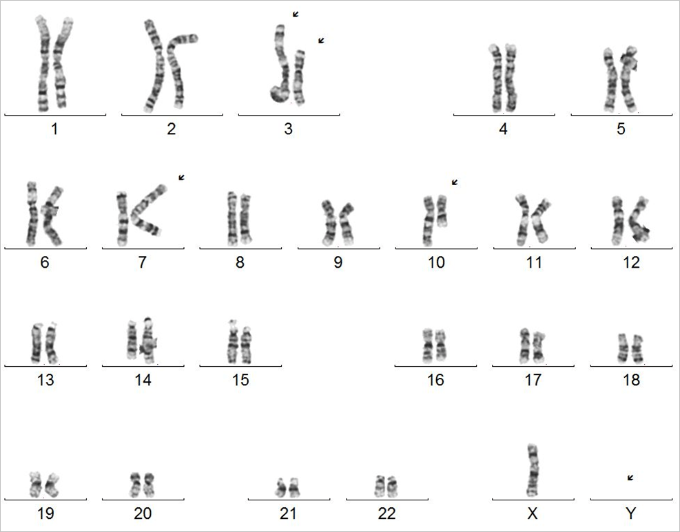 cytogenetics-analysis
