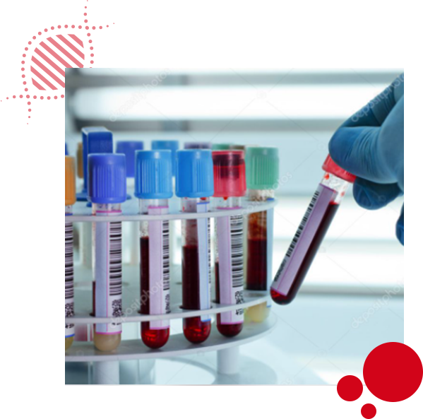 ServiceTestTube